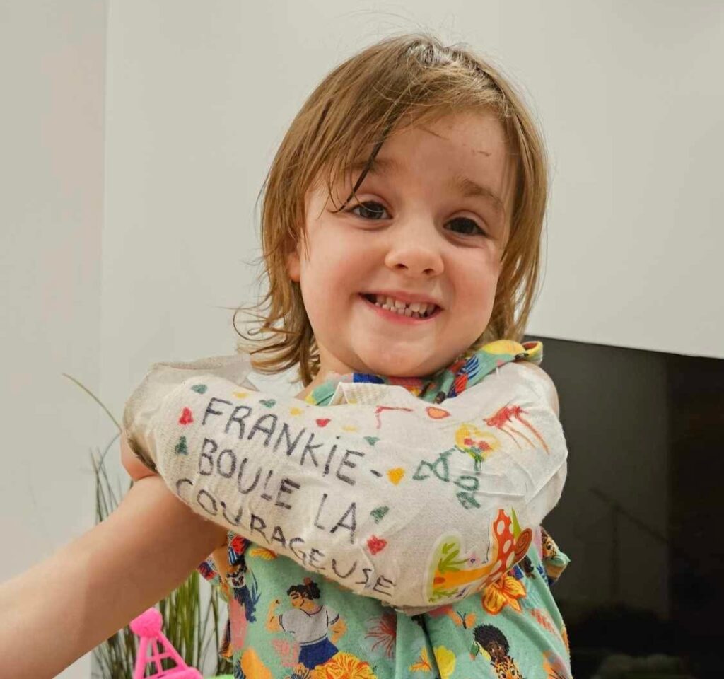 A little girl wearing a cast on her arm smiles. 